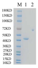 SDS-PAGE (KRT19-7239H).jpg